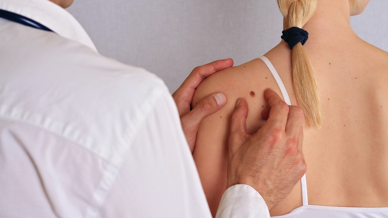 It is very important to regularly check for changes in moles.