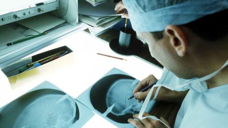 Irish Hospital Consultants Association says 500 permanent hospital consultant posts are unfilled