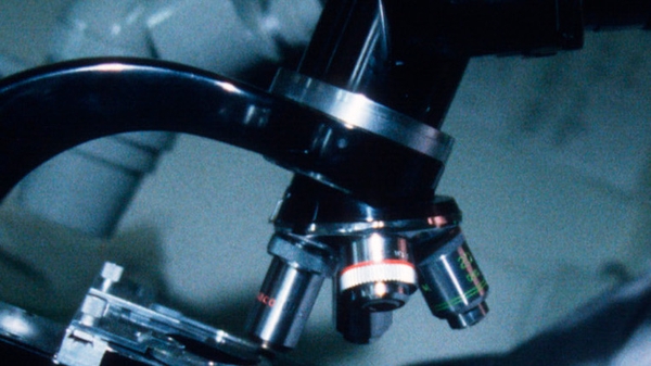 CPE is an antibiotic resistant superbug that lives in the gut or stomach