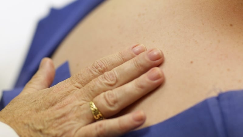 Research could help doctors treat different forms of melanoma