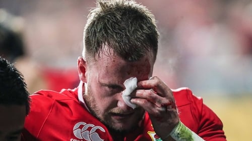 Stuart Hogg was forced to leave the Lions tour with a cheek injury