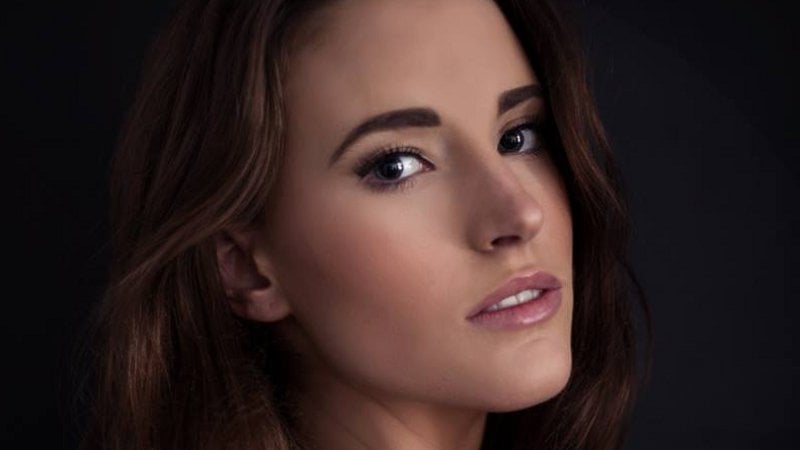 Cork model Katie O'Donoghue says she fears she will lose work after being left scarred. Picture credit: Fraser Models