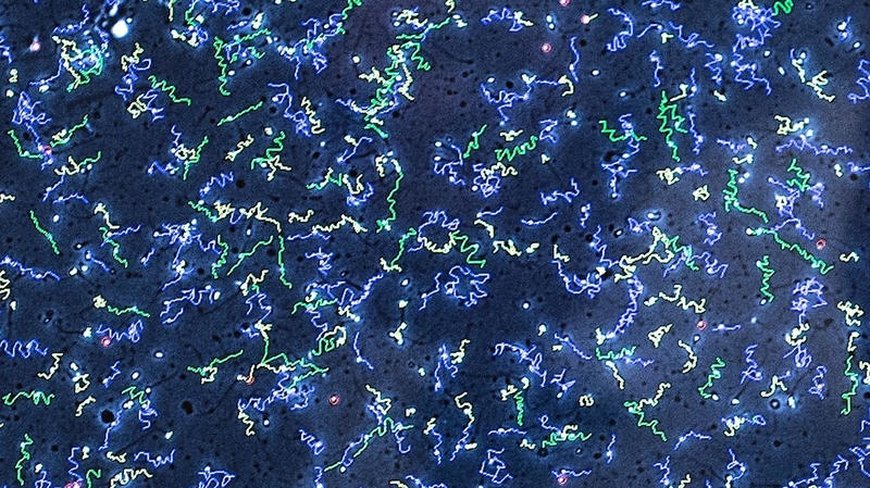 The average amount of sperm produced by men in the developed world has fallen by 60% in less than 40 years