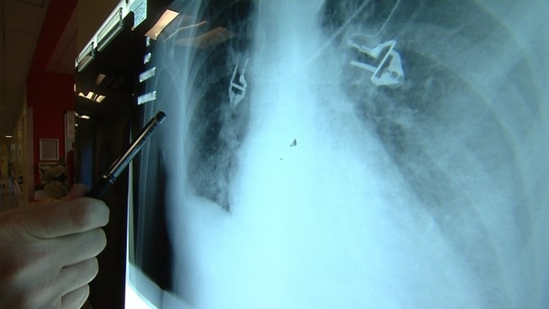 The scale of the problem with scans is not yet known