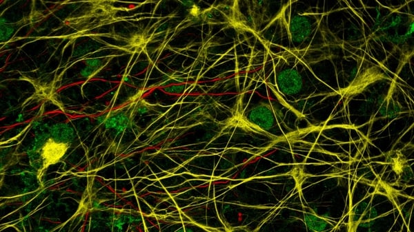A striking image from research work undertaken by Irish Research Council Scholar Maria Velasco