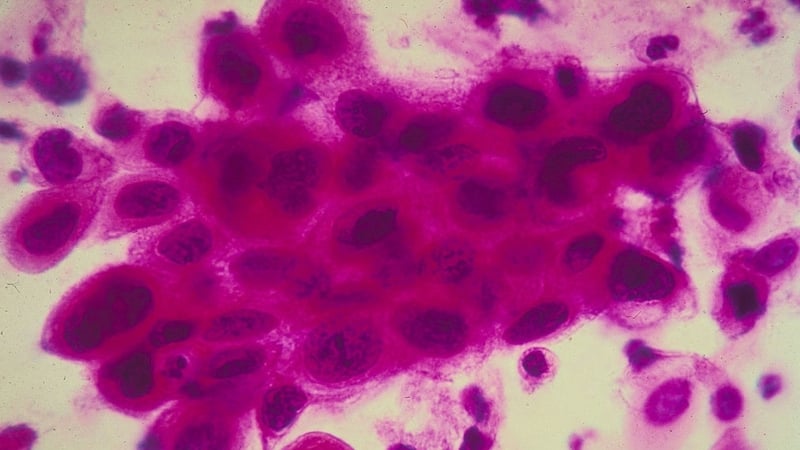 As there have been no effective new treatments over the past 30 years, there is a strong need for fresh ones to developed