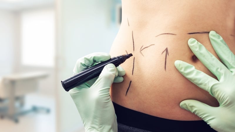 Thinking of having cosmetic surgery? Have you checked your 'Safety Diamond'? Read on