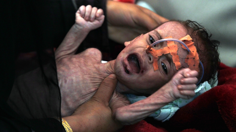 Seven million people are already at risk of famine in Yemen