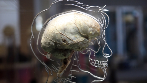 Aside from its role in alleviating depression, TMS plays an important role in understanding how the brain works more generally