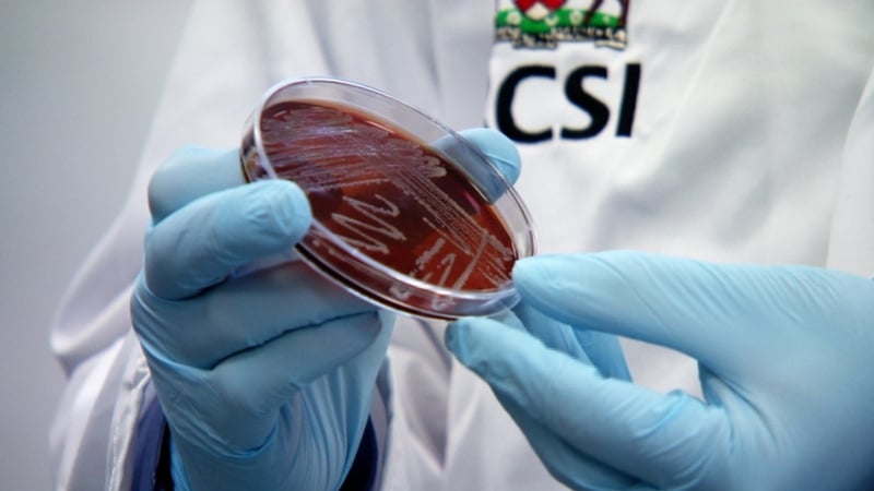 Sepsis claims more lives in Ireland than heart attack, breast cancer or lung cancer