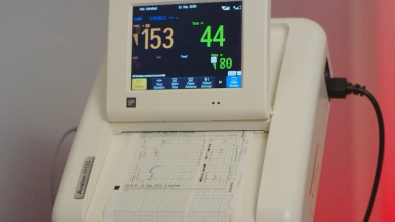 The Philips recall was sent to 11 Irish hospitals