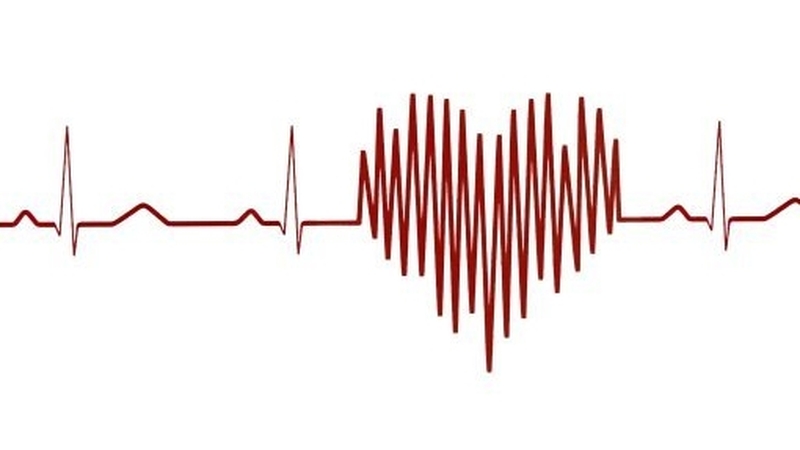 The nurse hooked himself up to an electrocardiogram which showed a complete heart block