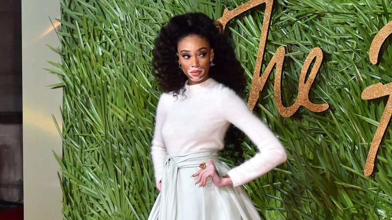 Winnie Harlow
