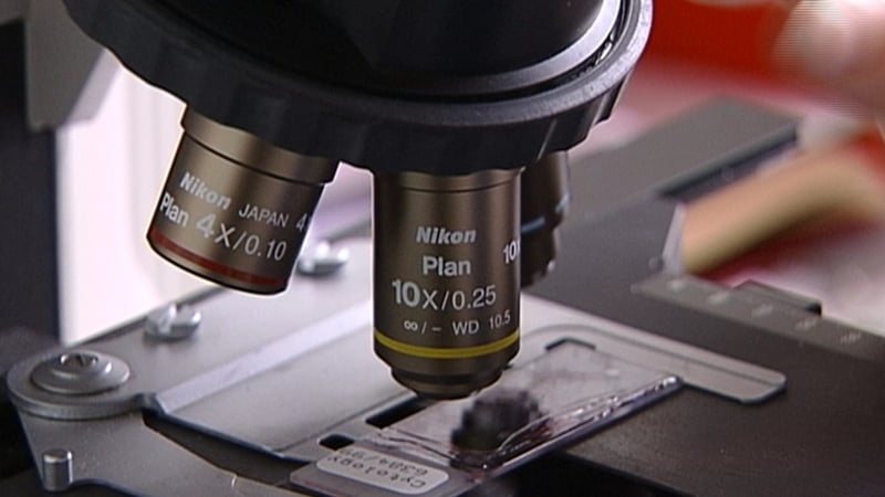 Patrick Lynch said women were entitled to know there was a review of their case and the outcome (File pic)