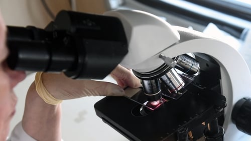 The review said greater expertise should be deployed across the screening services