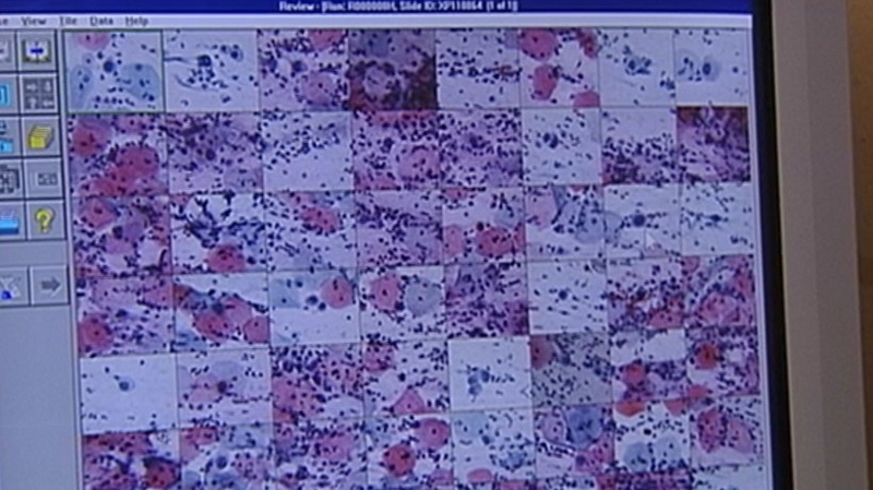 The minimum total insurance cover for each claim was set at €22.6m