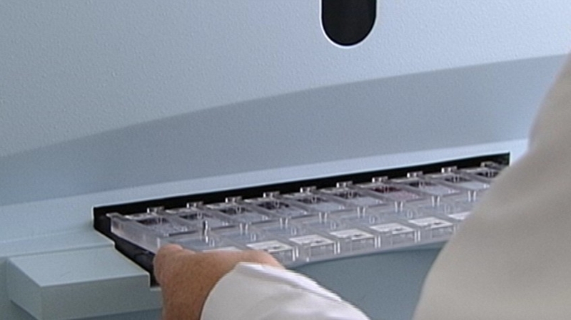 The HSE remains concerned over the length of time being taken for reporting of cervical smears