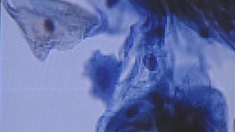 7,500 calls have also been received by the CervicalCheck helpline