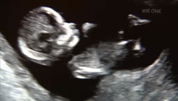 Prime Time - when does life begin? Tensions Mount In Gaza