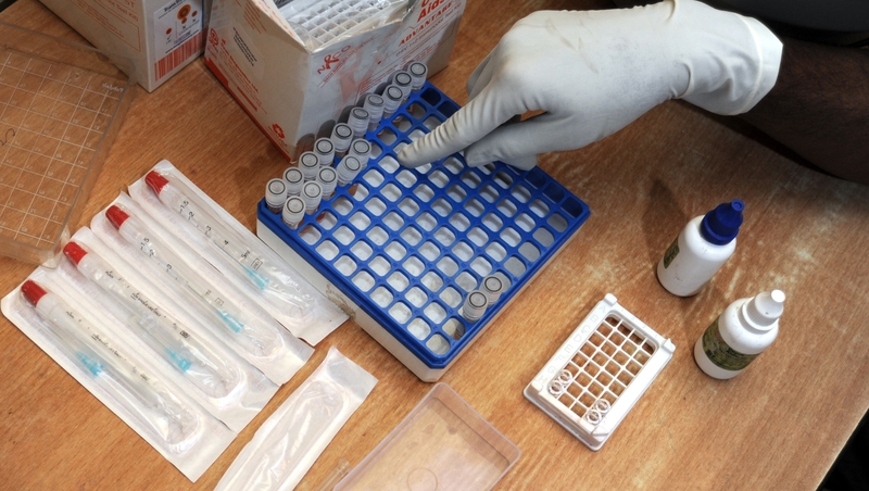 A HIV screening kit is prepared at a clinic in India