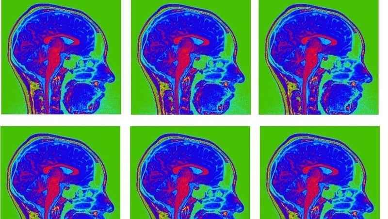 Brainstorm: "when you have a lot of experience in a certain area, the brain has more information to match the current experience against"