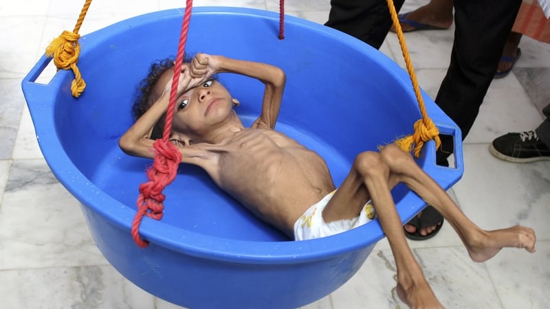 Jan Egeland said children are dying of starvation
