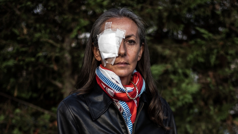 Corine Remande was hit by a Brooks Koepka tee shot last Friday at the Ryder Cup