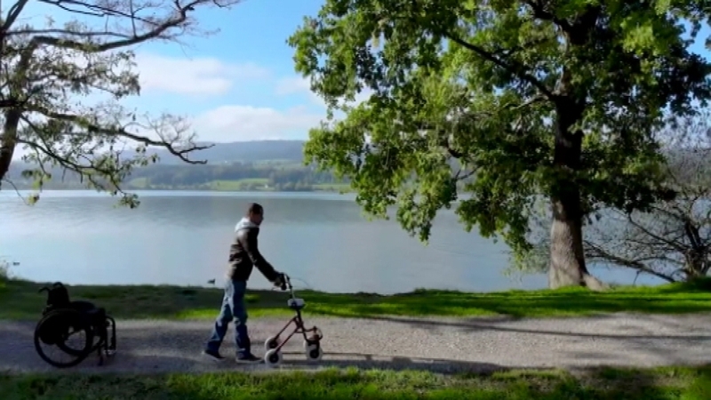 David Mzee who suffered full paralysis of his left leg in 2010 can walk with a walker using electrical stimulation