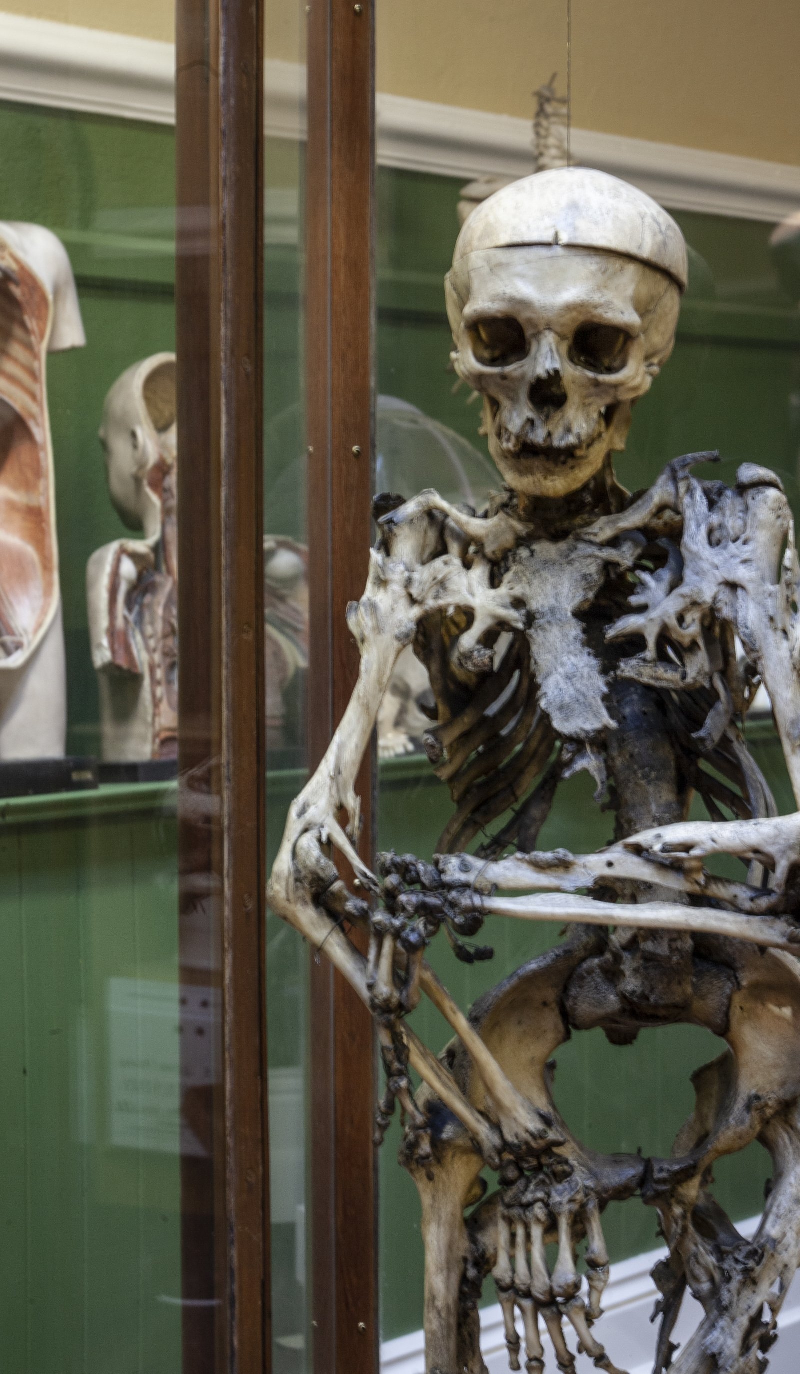 William Clark's skeleton at the Trinity Anatomical Museum, photo by Evi Numen.