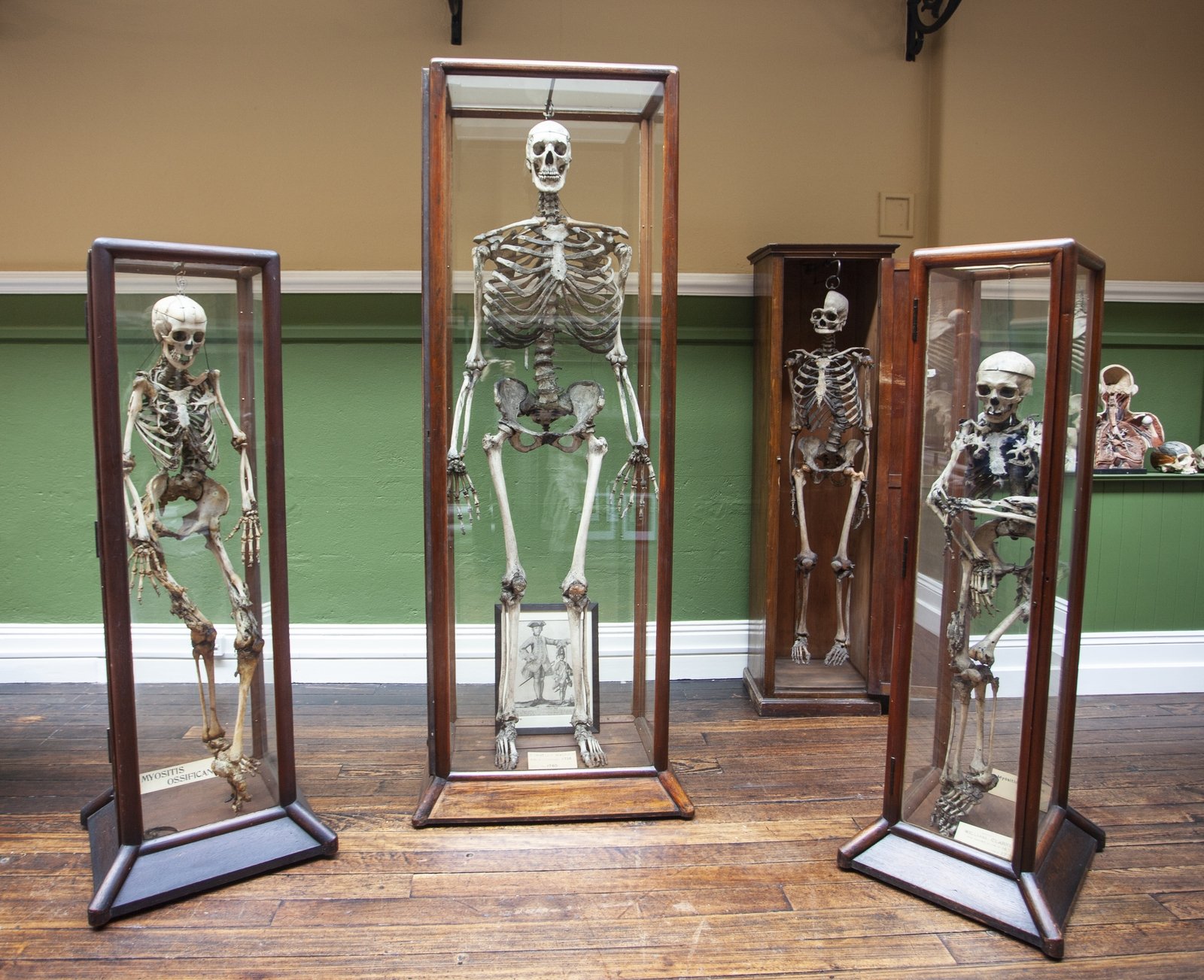 The skeleton of William Magrath (center). Photo by Evi Numen.