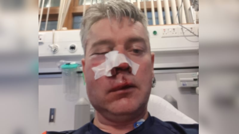 Daniel Sweeney was assaulted following a match in the midlands last weekend