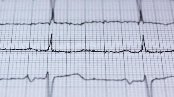 Lifesavers: Did you die?  'Three times... and three people brough