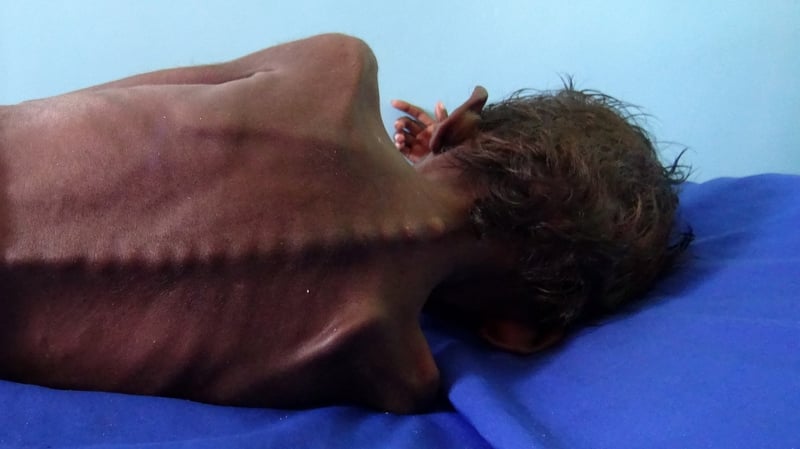 A UN conference is hoping to raise €3.7bn to fund humanitarian operations in Yemen