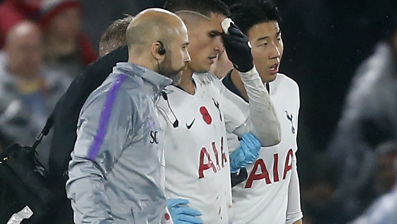 A new test may make it easier to diagnose concussion