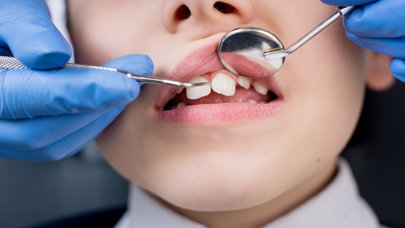 The Irish Dental Association said the backlog in parts of the country is running up to a decade (file image)