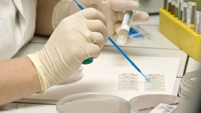 This study is the first evidence of the important role that brain chemical serotonin plays