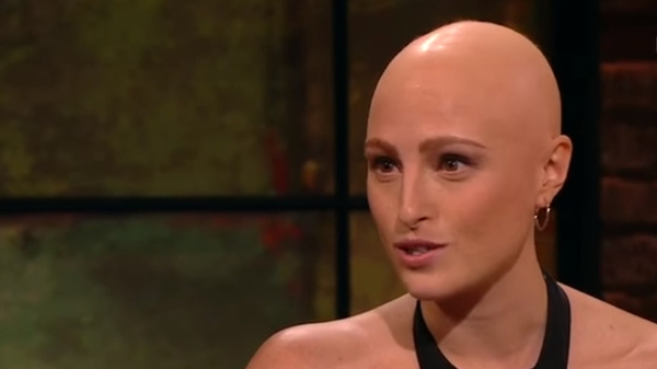 Amber Jean Rowan on discovering she had alopecia at 15
