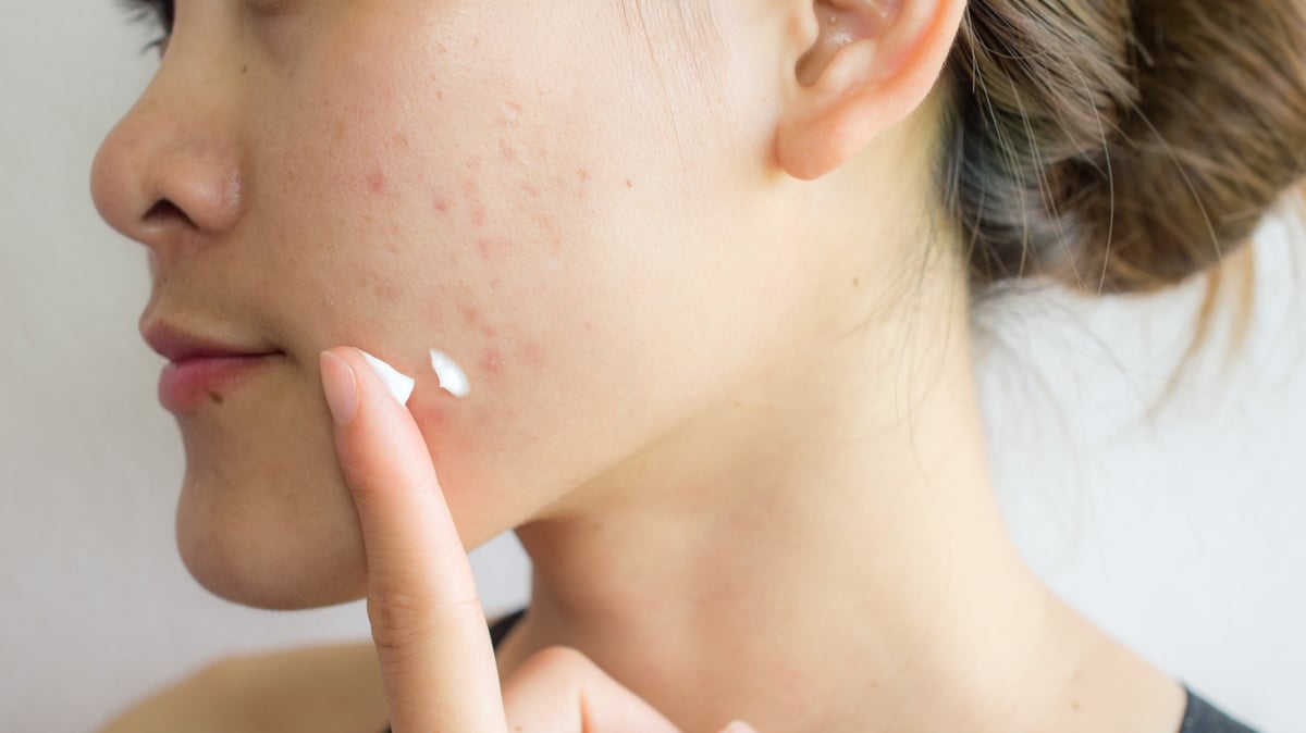 Skin problems in children and teenagers with Consultant dermatologist Rosemary Coleman