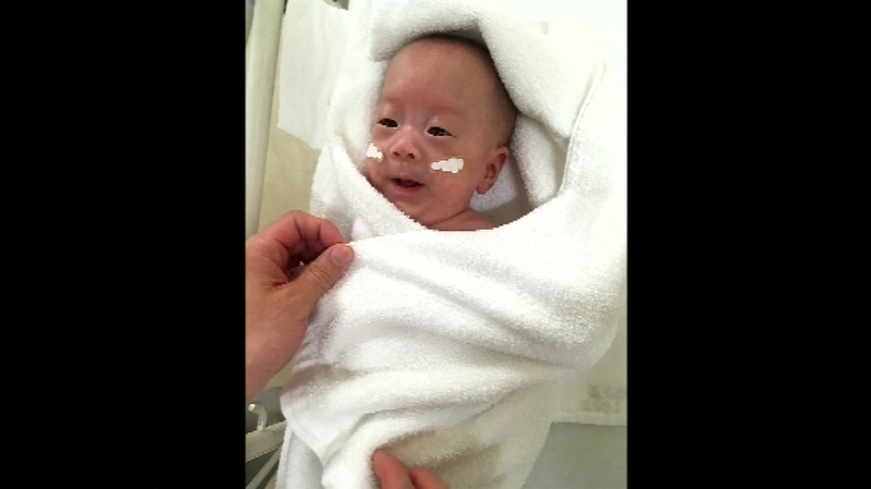 The baby weighs 3.238 kilos after five weeks of treatment (Pic: Keio University School of Medicine, Department of Pediatrics)