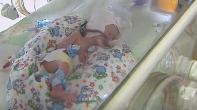 The babies weighed between 890g and 1.3kg