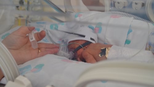 Alex was born 15 weeks' early, weighing the equivalent of just a half a bag of sugar