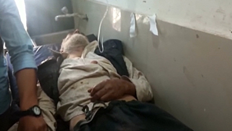 Local media reported that 17 were injured in the crash