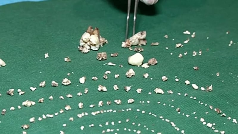 Doctors said it is a unique medical case