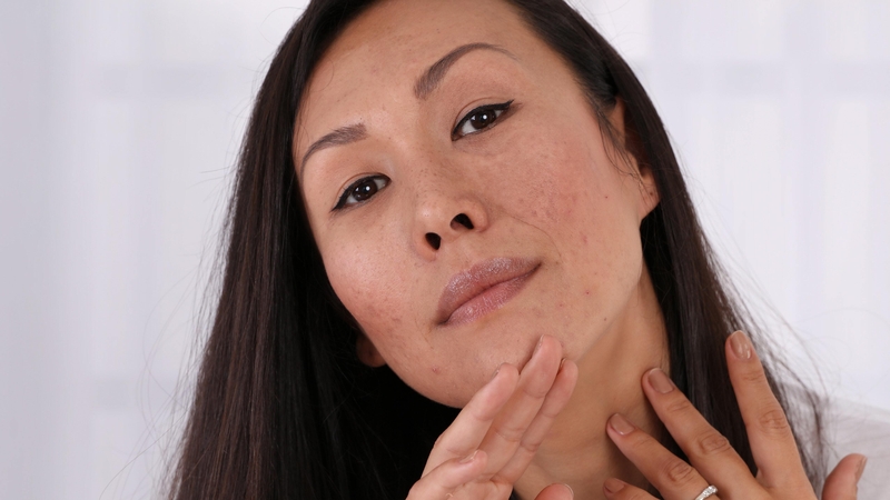 Skin expert Dr Ross Perry talks about the effects post pregnancy can have on your skin and what you can do to help it