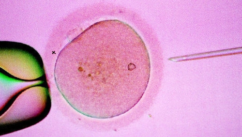 Under the proposed law, France's healthcare system would cover the cost of the procedure for all women under 43