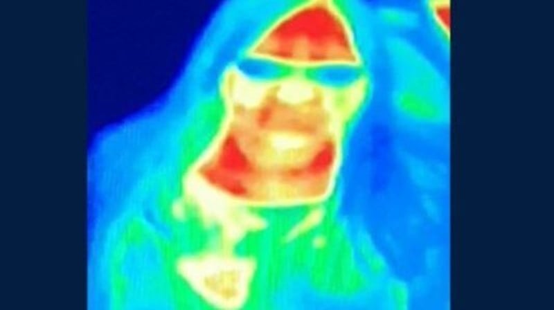 The camera shows a heat spot on one of Bal Gill's breasts (Pic Camera Obscura)