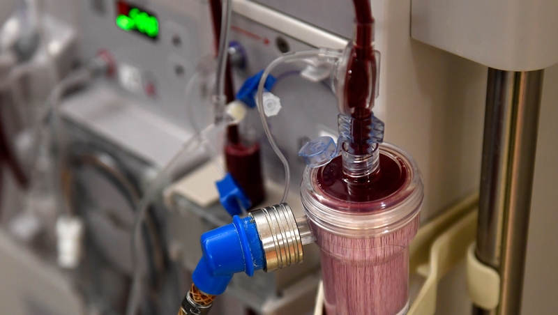 Patients receiving kidney dialysis could benefit from an AI wearable device
