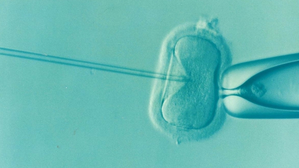 After three miscarriages, the word "recurrent" is used.