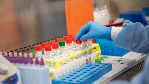 "In the Mercy University Hospital at present, it takes up to six hours to conduct any single test run, which may consist of up to 40 samples."