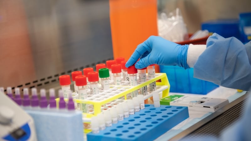 "In the Mercy University Hospital at present, it takes up to six hours to conduct any single test run, which may consist of up to 40 samples."